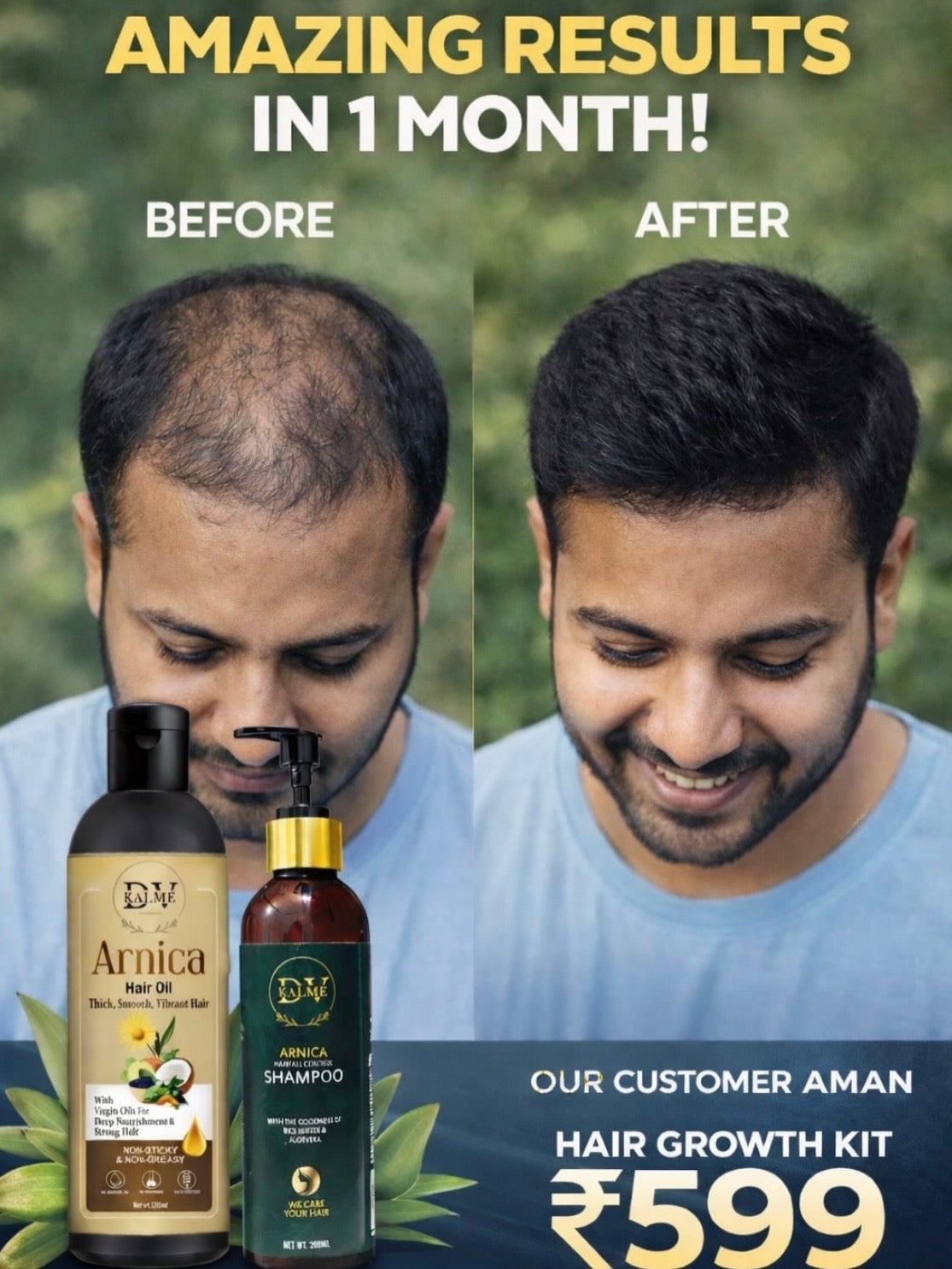 Hair Growth Kit